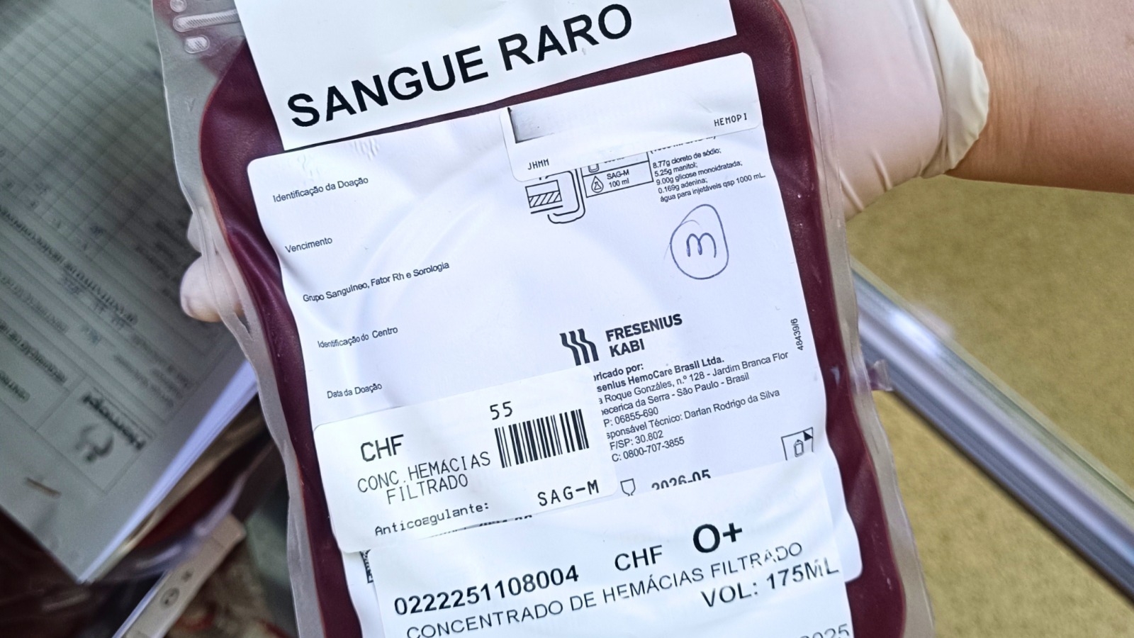 Cooperação entre Hemopi, Hemopa e Hemoce garante transfusão para criança com sangue raríssimo